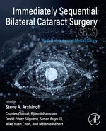 Immediately Sequential Bilateral Cataract Surgery (ISBCS)