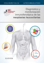 DiagnÃ³stico y monitorizaciÃ³n inmunofenotÃ­pica de las neoplasias leucocitarias