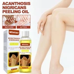 Bleaching Peeling Oil Brightening Dark Skin Removes MelaninAcanthosis Nigricans Exfoliating Peeling Dead Oil Elbow Arm Legs J6P9