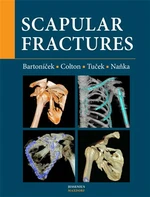 Scapular fractures - Jan Bartoníček, Ondřej Naňka, Michal Tuček, Christopher Colton