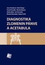 Diagnostika zlomenin pánve a acetabula - Jana Chmelová, Valér Džupa, Tomáš Pavelka, Jan Vavrečka, Václav Báča - e-kniha