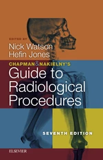 Chapman & Nakielny's Guide to Radiological Procedures E-Book