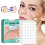 120pc/box Warts Remover Patch Skin Tags Pimple Treatments Cream Hydrocolloid Gel Foot Corn Plaster Acne Warts Invisible Stickers