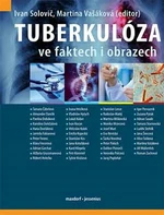 Tuberkulóza ve faktech i obrazech - Martina Vašáková, Solovič Ivan