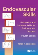 Endovascular Skills