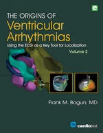 The Origins of Ventricular Arrhythmias, Volume 2