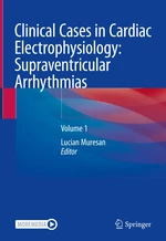 Clinical Cases in Cardiac Electrophysiology
