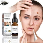 Wart Mole Removal Painless Fast Remover Serum Wart Tag Serum Skin Removal Mole Fast Remover Skin Care