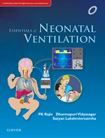 Essentials of Neonatal Ventilation, 1st edition, E-book