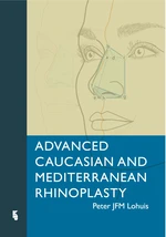 Advanced Caucasian and Mediterranean Rhinoplasty