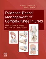 Evidence-Based Management of Complex Knee Injuries E-Book