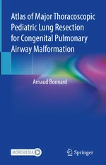 Atlas of Major Thoracoscopic Pediatric Lung Resection for Congenital Pulmonary Airway Malformation