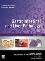 Gastrointestinal and Liver Pathology E-Book