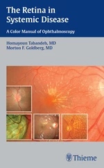 The Retina in Systemic Disease