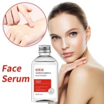 Nicotinamide Glycerin Essence Water Moisturizes The And Skin, The The Whole Body, Nourishes Refreshes Face E5J1