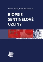 Biopsie sentinelové uzliny - Čestmír Neoral, Tomáš Bohanes - e-kniha