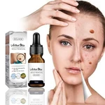 Wart Mole Removal Painless Fast Remover Serum Wart Tag Serum Skin Removal Mole Fast Remover Skin Care