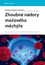 Zhoubné nádory močového měchýře, Poprach Alexandr