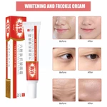 Whitening Anti Wrinkle And Lightening Freckle Cream Care Facial Cream Care Product Essence Skin Moisturizing And Firming Y2X9