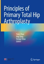 Principles of Primary Total Hip Arthroplasty