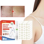 Warts Remover Plaster Skin Tags Remover Wart Treat Ment Quickly Remove Men And Women Skin Wart Formula Skin Tag Removal