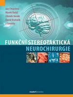 Funkční stereotaktická neurochirurgie - Zdeněk Novák, Jan Chrastina, Baláž Marek, Krahulík David