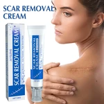 30g Scar Removing Cream Stretch Mark Removal Gel Face Body Acne Marks Injury Cesarean Burn Abrasions Scars Skin Repair Ointment
