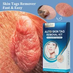 Auto Skin Tag Remover Kit Skin Tag Removal Device Kit Adult Mole Stain Wart Remover With Cleansing Swabs Face Care Beauty Tools